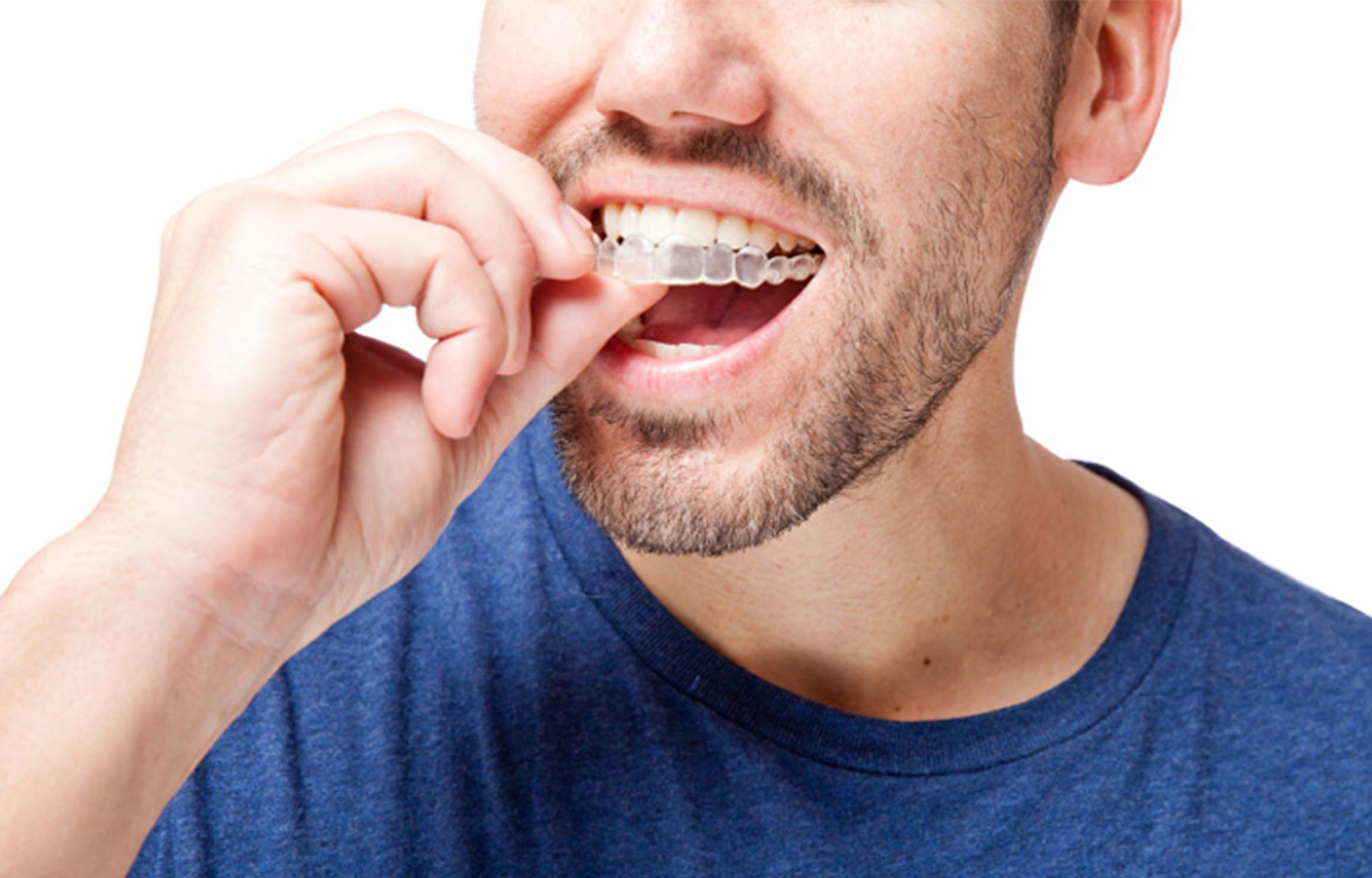 The Ranch Orthodontics | Early Treatment, Invisalign and Traditional Braces